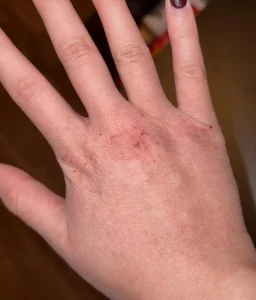 Can the Wrong Hand Soap Damage Your Skin at Work?