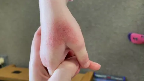 Can the Wrong Hand Soap Damage Your Skin at Work?
